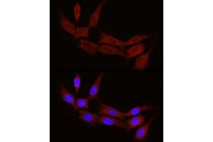 Immunofluorescence analysis of NIH/3T3 cells using STX17 Rabbit pAb (ABIN7270682) at dilution of 1:100 (40x lens).