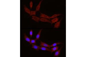 Immunofluorescence analysis of NIH/3T3 cells using STX17 Rabbit pAb (ABIN7270682) at dilution of 1:100 (40x lens). (Syntaxin 17 anticorps  (AA 1-130))
