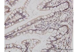 Image no. 2 for anti-GA Binding Protein Transcription Factor, alpha Subunit 60kDa (GABPA) (AA 1-101) antibody (ABIN598704)