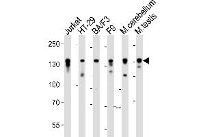 Western blot analysis of lysates from Jurkat, HT-29, mouse BA/F3, mouse F9 cell line, mouse cerebellum, mouse testis tissue (from left to right), using Mouse Ctr9 Antibody (C-term) (ABIN6243851 and ABIN6577807). (CTR9 anticorps  (C-Term))