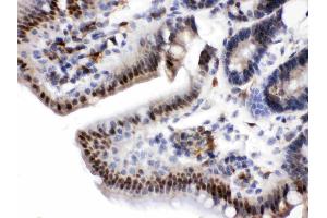 Visfatin was detected in paraffin-embedded sections of rat intestine tissues using rabbit anti- Visfatin Antigen Affinity purified polyclonal antibody (Catalog # ) at 1 µg/mL. (NAMPT anticorps  (AA 62-337))