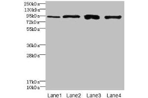 Western blot All lanes: XRRA1 antibody at 6 μg/mL Lane 1: HepG2 whole cell lysate Lane 2: Mouse kidney tissue Lane 3: HL60 whole cell lysate Lane 4: U251 whole cell lysate Secondary Goat polyclonal to rabbit IgG at 1/10000 dilution Predicted band size: 90, 68, 89, 84, 59 kDa Observed band size: 90 kDa (XRRA1 anticorps  (AA 101-400))