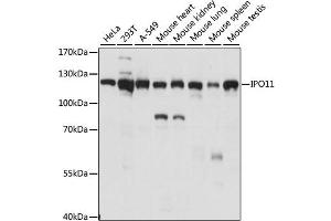Western blot analysis of extracts of various cell lines, using IPO11 antibody (ABIN6290517) at 1:1000 dilution.