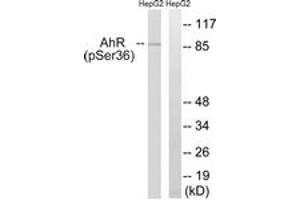 Western blot analysis of extracts from HepG2 cells, using AhR (Phospho-Ser36) Antibody. (Aryl Hydrocarbon Receptor anticorps  (pSer36))