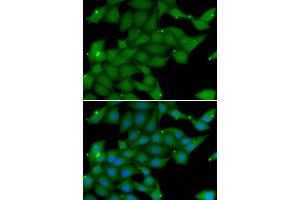 Immunofluorescence analysis of U20S cell using RASGRF1 antibody. (RASGRF1 anticorps)