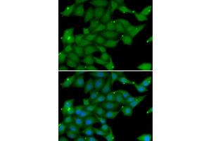 Immunofluorescence analysis of U20S cell using RASGRF1 antibody. (RASGRF1 anticorps)