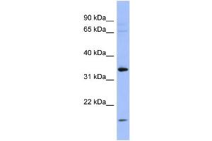 WB Suggested Anti-PYCR1  Antibody Titration: 0. (PYCR1 anticorps  (Middle Region))