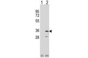 Western blot analysis of RPA2 (arrow) using rabbit polyclonal RPA2 Antibody (N-term) . (RPA2 anticorps  (N-Term))