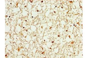 IHC image of ABIN7175838 diluted at 1:100 and staining in paraffin-embedded human brain tissue performed on a Leica BondTM system.