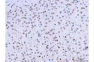 IHC analysis of HnRNP H/HNRNPH1 using anti-HnRNP H/HNRNPH1 antibody (ABIN4886623). (HNRNPH1 anticorps  (N-Term))