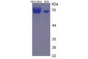 Image no. 2 for Vitamin B12 protein (BSA) (ABIN1880114) (Vitamin B12 Protein (BSA))