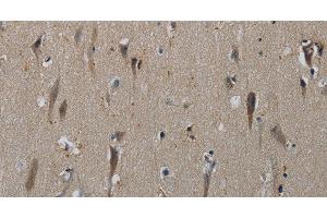 Immunohistochemistry of paraffin-embedded Human brain tissue using HSPG2 Polyclonal Antibody at dilution 1:50 (HSPG2 anticorps)