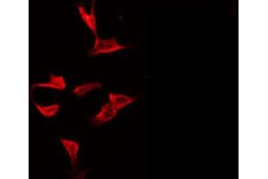 ABIN6272429 staining HeLa by IF/ICC. (Septin 8 anticorps  (Internal Region))