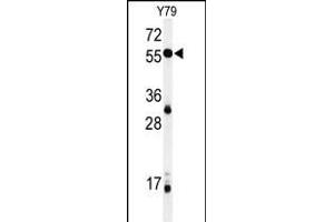 Western blot analysis of NOB1 Antibody (C-term) (ABIN651015 and ABIN2840039) in Y79 cell line lysates (35 μg/lane). (NOB1 anticorps  (C-Term))