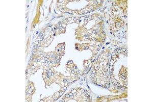 Immunohistochemistry of paraffin-embedded human prostate using CFD antibody.