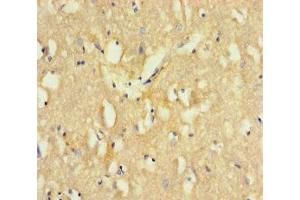 Immunohistochemistry of paraffin-embedded human brain tissue using ABIN7171199 at dilution of 1:100 (Sorting Nexin 1 anticorps  (AA 1-250))