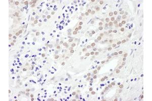 anti-Exosome Component 10 (EXOSC10) (AA 750-800) antibody
