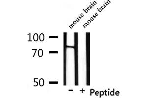 Western blot analysis of extracts from mouse brain, using NOL11 Antibody. (NOL11 anticorps)
