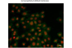 Sample Type :  Eye tissue (ZEB1 anticorps  (N-Term))