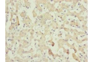 Immunohistochemistry of paraffin-embedded human liver tissue using ABIN7148369 at dilution of 1:100 (C8A anticorps  (AA 310-460))