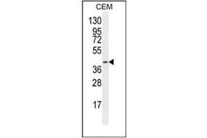 Western blot analysis of F8A2 Antibody (N-term) in CEM cell line lysates (35ug/lane). (F8A2 anticorps  (N-Term))
