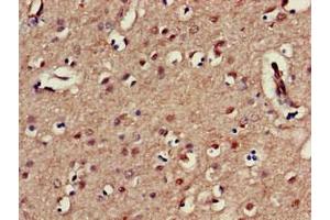 Immunohistochemistry of paraffin-embedded human brain tissue using ABIN7157524 at dilution of 1:100
