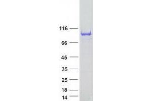 Validation with Western Blot