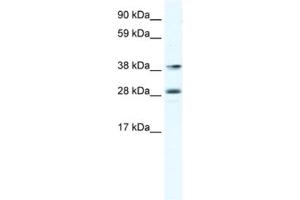 Western Blotting (WB) image for anti-Myocyte Enhancer Factor 2B (MEF2B) antibody (ABIN2461444)