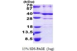 SDS-PAGE (SDS) image for Bartter Syndrome, Infantile, with Sensorineural Deafness (Barttin) (BSND) (AA 54-320) protein (His tag) (ABIN6387238)