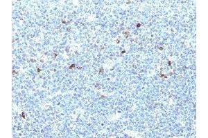Formalin-fixed, paraffin-embedded human tonsil stained with HLA-Aw32 / HLA-A25 antibody (CATA-1). (HLA-Aw32-&-HLA-A25 (MHC-I) anticorps)