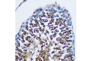 Immunohistochemistry of paraffin-embedded Rat testis using ST Rabbit pAb (ABIN1682908, ABIN1682909, ABIN5664112 and ABIN6219730) at dilution of 1:100 (40x lens). (STAT4 anticorps  (AA 600-700))