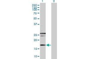 Western Blot analysis of RHEB expression in transfected 293T cell line by RHEB MaxPab polyclonal antibody. (RHEB anticorps  (AA 1-184))