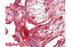 Human Placenta: Formalin-Fixed, Paraffin-Embedded (FFPE) (DAB2 anticorps  (AA 743-770))