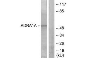 Western blot analysis of extracts from lOVO cells, using ADRA1A Antibody. (alpha 1 Adrenergic Receptor anticorps  (AA 341-390))
