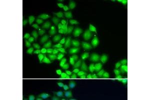 Immunofluorescence analysis of HeLa cells using ERCC2 Polyclonal Antibody (ERCC2 anticorps)