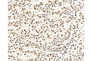 IHC analysis of DBC-1/CCAR2 using anti-DBC-1/CCAR2 antibody (ABIN7602235). (CCAR2 anticorps  (AA 65-917))