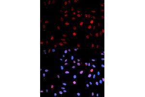 Immunofluorescence (IF) image for anti-Tumor Protein P53 (TP53) (pSer15) antibody (ABIN1870674) (p53 anticorps  (pSer15))