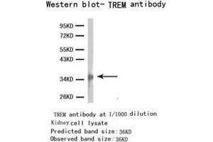 Western Blotting (WB) image for anti-Triggering Receptor Expressed On Myeloid Cells 1 (TREM1) antibody (ABIN1875201) (TREM1 anticorps)