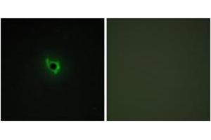 Immunofluorescence analysis of COS7 cells, using EPHA6 Antibody.