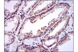 Immunohistochemical analysis of paraffin-embedded prostate tissues using UBE2I mouse mAb with DAB staining.