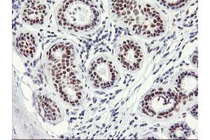 Immunohistochemical staining of paraffin-embedded Human breast tissue using anti-OBFC2B mouse monoclonal antibody. (SSBP1 anticorps)