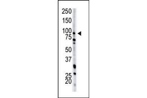 Image no. 1 for anti-phosphofructokinase, Muscle (PFKM) (N-Term) antibody (ABIN360632) (PFKM anticorps  (N-Term))