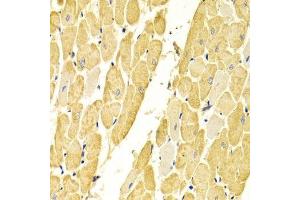 Immunohistochemistry of paraffin-embedded rat heart using CA3 Antibody.