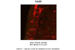 Sample Type :  Mouse Gut Tissue TgWnt1-Cre/+ Ednrbflex3/+ Rosa26YFPStop/YFPStop  Primary Antibody Dilution :  1:50  Secondary Antibody :  Goat anti-rabbit-cy3  Secondary Antibody Dilution :  1:1500  Color/Signal Descriptions :  Ddx20: Green Neural crest cells:: Red  Gene Name :  Ddx20  Submitted by :  Anonymous