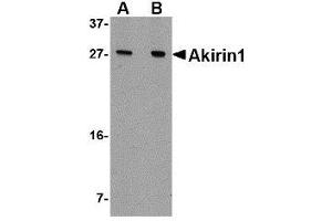 Western blot analysis of Akirin1 in A549 cell lysate with AP30038PU-N Akirin1 antibody at (A) 1 and (B) 2 μg/ml. (Akirin 1 anticorps  (N-Term))