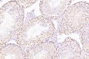 Immunohistochemistry analysis of paraffin-embedded mouse testis using,NCAPG2 (ABIN7074856) at dilution of 1: 1600 (NCAPG2 anticorps)