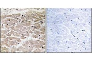Immunohistochemistry analysis of paraffin-embedded human heart tissue, using CBCP2 Antibody.
