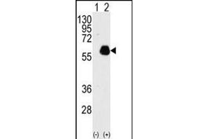Western blot analysis of PXN(arrow) using rabbit polyclonal PXN Antibody  (ABIN390376 and ABIN2840778). (Paxillin anticorps  (AA 94-125))
