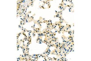 Immunohistochemistry of paraffin embedded mouse lung using Thymosin (ABIN7075306) at dilution of 1:750 (400x lens)