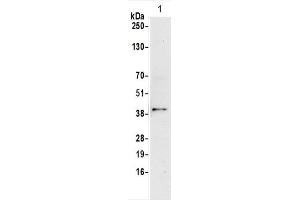Western blot analysis of CD147 expression in HUVEC cells